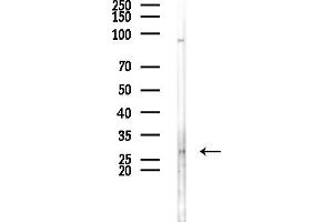 anti-CDC42 Effector Protein (Rho GTPase Binding) 2 (CDC42EP2) (N-Term) antibody