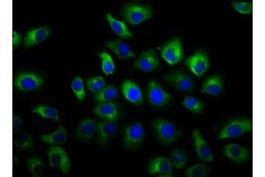 Immunofluorescence staining of A549 cells with ABIN7153831 at 1:66, counter-stained with DAPI. (GSG1-Like Antikörper  (AA 84-176))