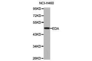 Western Blotting (WB) image for anti-Ectodysplasin A (EDA) antibody (ABIN1872415)