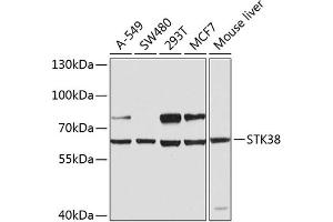Western blot analysis of extracts of various cell lines, using STK38 antibody (ABIN6132692, ABIN6148616, ABIN6148617 and ABIN6224215) at 1:1000 dilution. (STK38 Antikörper  (AA 1-200))
