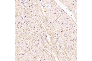 Immunohistochemistry analysis of paraffin-embedded rat heart using,Myoz2 (ABIN7074744) at dilution of 1: 6000 (MYOZ2 Antikörper)