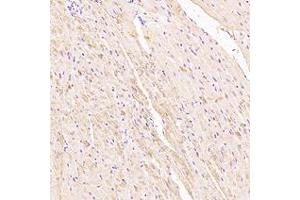 Immunohistochemistry analysis of paraffin-embedded rat heart using,Myoz2 (ABIN7074744) at dilution of 1: 6000