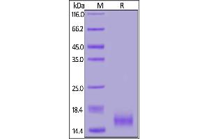 Human CD59, His Tag on  under reducing (R) condition. (CD59 Protein (CD59) (AA 26-102) (His tag))