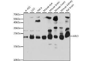 Western blot analysis of extracts of various cell lines, using  antibody (ABIN7265493) at 1:1000 dilution. (ARL3 Antikörper  (AA 1-182))
