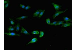 Immunofluorescent analysis of Hela cells using ABIN7158215 at dilution of 1:100 and Alexa Fluor 488-congugated AffiniPure Goat Anti-Rabbit IgG(H+L) (LSMEM1 Antikörper  (AA 1-131))