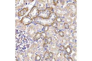 Immunohistochemistry of paraffin-embedded rat kidney using PPL antibody at dilution of 1:100 (x400 lens). (PPL Antikörper)