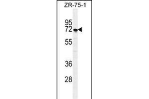 SUSD5 Antibody (C-term) (ABIN655447 and ABIN2844977) western blot analysis in ZR-75-1 cell line lysates (35 μg/lane). (SUSD5 Antikörper  (C-Term))