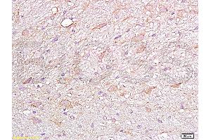 Formalin-fixed and paraffin embedded rat brain labeled Anti-FGFR4 Polyclonal Antibody, Unconjugated (ABIN671766) at 1:200, followed by conjugation to the secondary antibody and DAB staining (FGFR4 Antikörper  (AA 1-100))