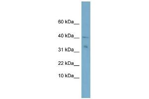 WB Suggested Anti-NDUFV3 Antibody Titration:  0.