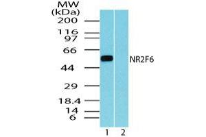 Image no. 1 for anti-Nuclear Receptor Subfamily 2, Group F, Member 6 (NR2F6) (AA 20-70) antibody (ABIN960291) (NR2F6 Antikörper  (AA 20-70))