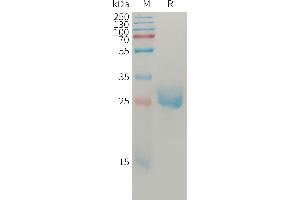 SDS-PAGE (SDS) image for Angiopoietin 2 (ANGPT2) (AA 275-496) protein (His tag) (ABIN7491345)