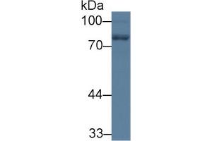Western Blot; Sample: Rat Cerebrum lysate; Primary Ab: 1µg/ml Rabbit Anti-Human NEFL Antibody Second Ab: 0. (NEFL Antikörper  (AA 281-396))