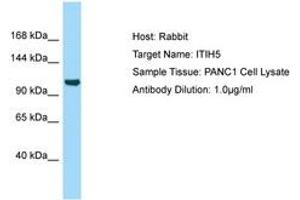 Image no. 1 for anti-Inter alpha Globulin Inhibitor H5 (ITIH5) (AA 92-141) antibody (ABIN6750011)