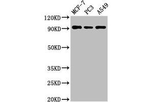 Western Blot Positive WB detected in: MCF-7 whole cell lysate, PC-3 whole cell lysate, A549 whole cell lysate All lanes: AMPD1 antibody at 3 μg/mL Secondary Goat polyclonal to rabbit IgG at 1/50000 dilution Predicted band size: 91, 90 kDa Observed band size: 91 kDa (AMPD1 Antikörper  (AA 97-272))