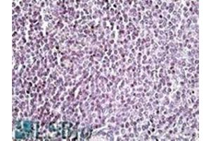 AP22454PU-N AIM2 antibody staining of paraffin embedded Human Spleen at 3. (AIM2 Antikörper  (C-Term))