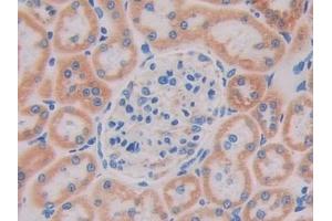 Immunohistochemistry (IHC) image for anti-Single Immunoglobulin and Toll-Interleukin 1 Receptor (TIR) Domain (SIGIRR) (AA 1-118) antibody (ABIN7437206)