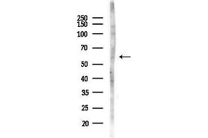 anti-thromboxane A Synthase 1 (Platelet) (TBXAS1) (N-Term) antibody