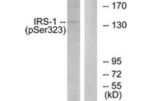 Western blot analysis of extracts from COS7 cells treated with Serum 20% 15', using IRS-1 (Phospho-Ser323) Antibody. (IRS1 Antikörper  (pSer323))