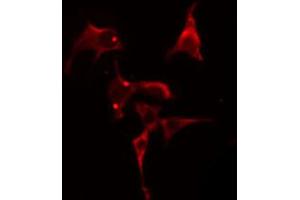 ABIN6274809 staining Hela cells by IF/ICC. (LPCAT2 Antikörper  (N-Term))