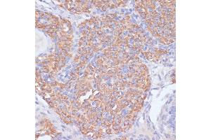 Immunohistochemistry of paraffin-embedded rat ovary using PI3 Kinase p85 beta antibody (ABIN7269320) at dilution of 1:200 (40x lens). (PIK3R2 Antikörper)