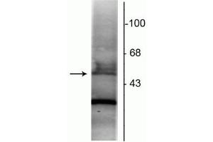 Western blot of rat hippocampal lysate showing specific immunolabeling of the ~48 kDa RAR-α protein. (Retinoic Acid Receptor alpha Antikörper  (N-Term))