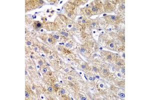 Immunohistochemistry of paraffin-embedded human liver injury using DPP3 antibody. (DPP3 Antikörper)