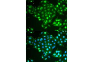 Immunofluorescence analysis of HeLa cells using ABCA3 antibody (ABIN5974136). (ABCA3 Antikörper)