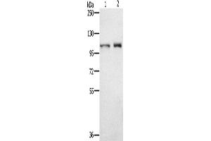 Western Blotting (WB) image for anti-Outer Dense Fiber of Sperm Tails 2 (ODF2) antibody (ABIN2430582)