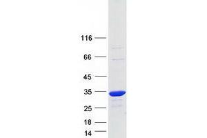 Validation with Western Blot (BPGM Protein (Transcript Variant 2) (Myc-DYKDDDDK Tag))