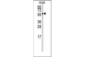 Image no. 1 for anti-Cytochrome P450, Family 4, Subfamily Z, Polypeptide 1 (CYP4Z1) (N-Term) antibody (ABIN360253) (CYP4Z1 Antikörper  (N-Term))