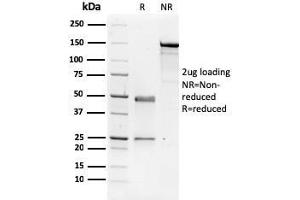 SDS-PAGE Analysis Purified NME1 / nm23-H1 Mouse Monoclonal Antibody (CPTC-NME1-2). (NME1 Antikörper)