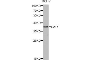 Western blot analysis of extracts of MCF-7 cells, using E2F6 antibody. (E2F6 Antikörper)