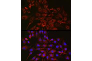 Immunofluorescence analysis of NIH/3T3 cells using P4H Rabbit pAb (ABIN1681193, ABIN3018745, ABIN3018746 and ABIN6220566) at dilution of 1:50 (40x lens). (P4HA2 Antikörper  (AA 234-533))