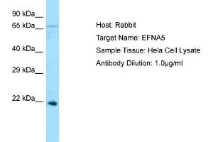 Western Blotting (WB) image for anti-Ephrin A5 (EFNA5) (N-Term) antibody (ABIN2790146) (Ephrin A5 Antikörper  (N-Term))