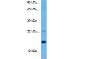 Host:  Rat  Target Name:  UBE2D1  Sample Tissue:  Rat Skeletal Muscle  Antibody Dilution:  1ug/ml (UBE2D1 Antikörper  (Middle Region))