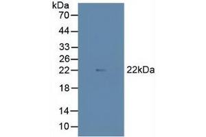 Figure. (MAX Antikörper  (AA 2-160))