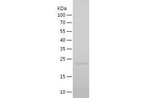 Cyclin A1 Protein (CCNA1) (AA 18-172) (His tag)