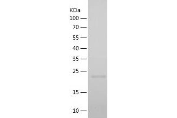 Cyclin A1 Protein (CCNA1) (AA 18-172) (His tag)