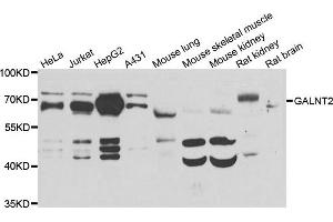 Western blot analysis of extracts of various cell lines, using GALNT2 antibody. (GALNT2 Antikörper)