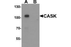 Western blot analysis of CASK in mouse brain tissue lysate with CASK antibody at 1 µg/mL in (A) the absence and (B) the presence of blocking peptide. (CASK Antikörper  (N-Term))