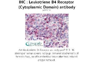 Image no. 1 for anti-Leukotriene B4 Receptor (LTB4R) (1st Cytoplasmic Domain) antibody (ABIN1736420) (Leukotriene B4 Receptor/BLT Antikörper  (1st Cytoplasmic Domain))