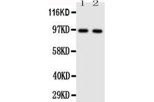 Anti-TLR4 antibody, Western blotting Lane 1: HELA Cell Lysate  Lane 2: SMMC Cell Lysate (TLR4 Antikörper  (N-Term))