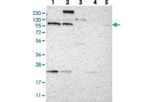 Western blot analysis of Lane 1: RT-4, Lane 2: U-251 MG, Lane 3: Human Plasma, Lane 4: Liver, Lane 5: Tonsil with TMF1 polyclonal antibody  at 1:250-1:500 dilution. (TMF1 Antikörper)