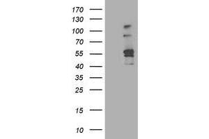 Image no. 1 for anti-Aldehyde Dehydrogenase 3 Family, Member A2 (ALDH3A2) antibody (ABIN1496595) (ALDH3A2 Antikörper)