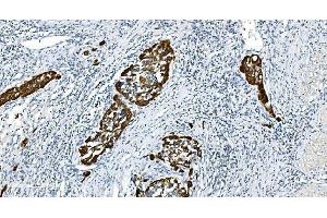IHC analysis of Glycine decarboxylase/GLDC using anti-Glycine decarboxylase/GLDC antibody (ABIN7602073).