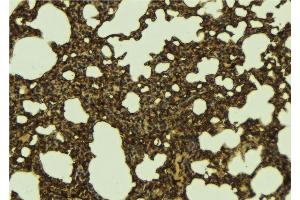 ABIN6276705 at 1/100 staining Mouse lung tissue by IHC-P. (RENT1/UPF1 Antikörper)