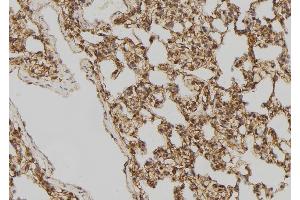 ABIN6275518 at 1/100 staining Rat lung tissue by IHC-P. (DVL2 Antikörper  (C-Term))