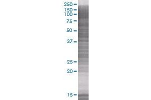 EPOR transfected lysate. (EPOR 293T Cell Transient Overexpression Lysate(Denatured))
