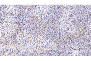 Immunohistochemistry (IHC) image for anti-Glycated Hemoglobin HbA1c (HbA1c) antibody (ABIN7431281)