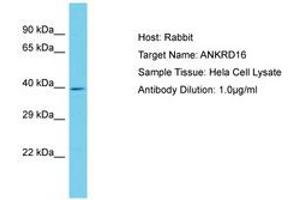 Image no. 1 for anti-Ankyrin Repeat Domain 16 (ANKRD16) (AA 43-92) antibody (ABIN6750615) (ANKRD16 Antikörper  (AA 43-92))